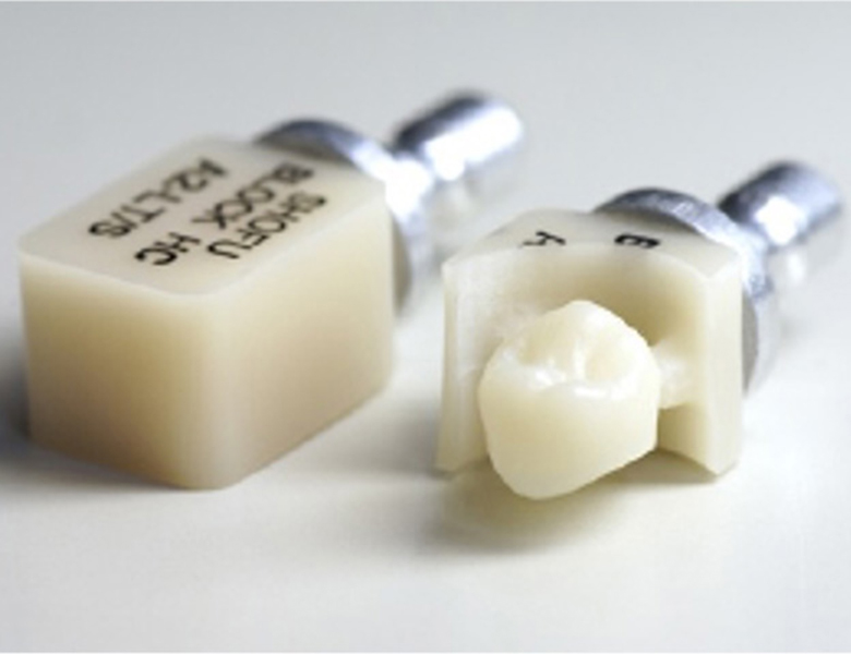 北千住デンタルクリニックで、保険で白い歯を