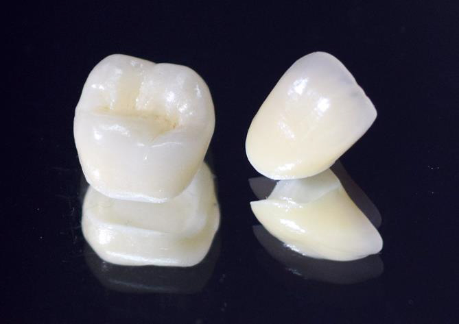 北千住デンタルクリニックで、保険で白い歯を